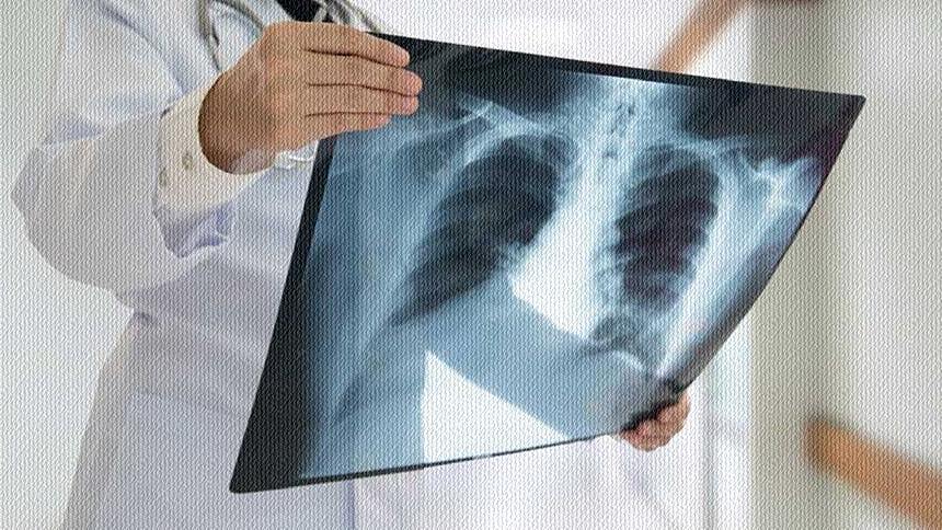 Hastane Rontgen Grip